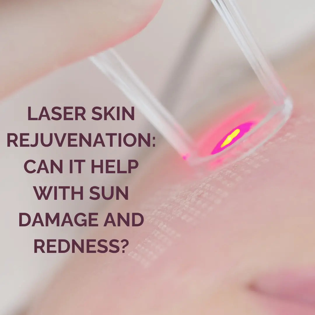 Laser Skin Rejuvenation: Can it Help With Sun Damage and Redness? - ColoradoBeautyRN