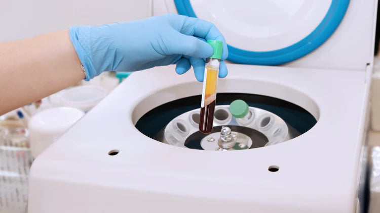 a hand holding a tube for microneedling with PRP