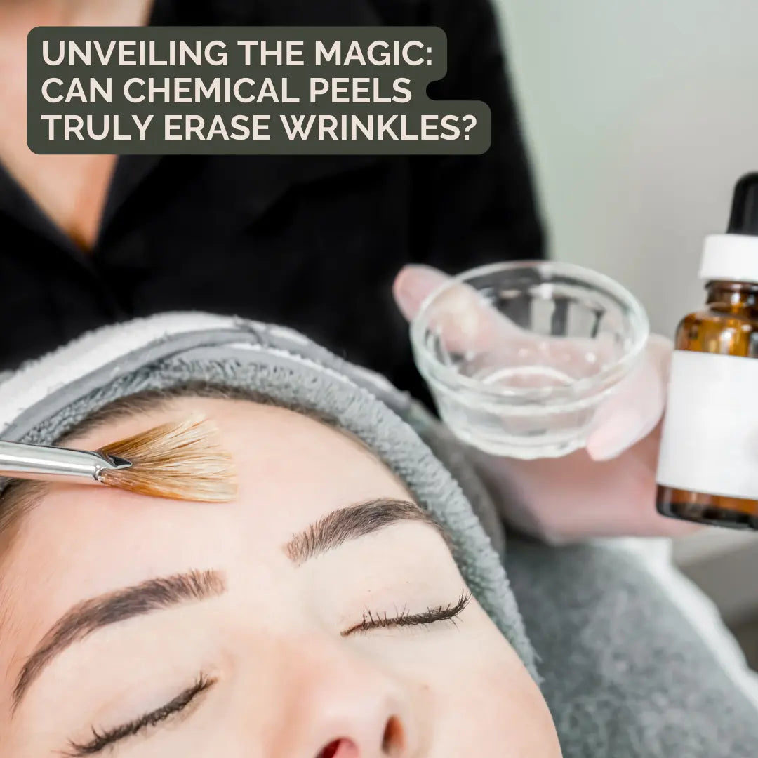 chemical peels at colorado beauty rn