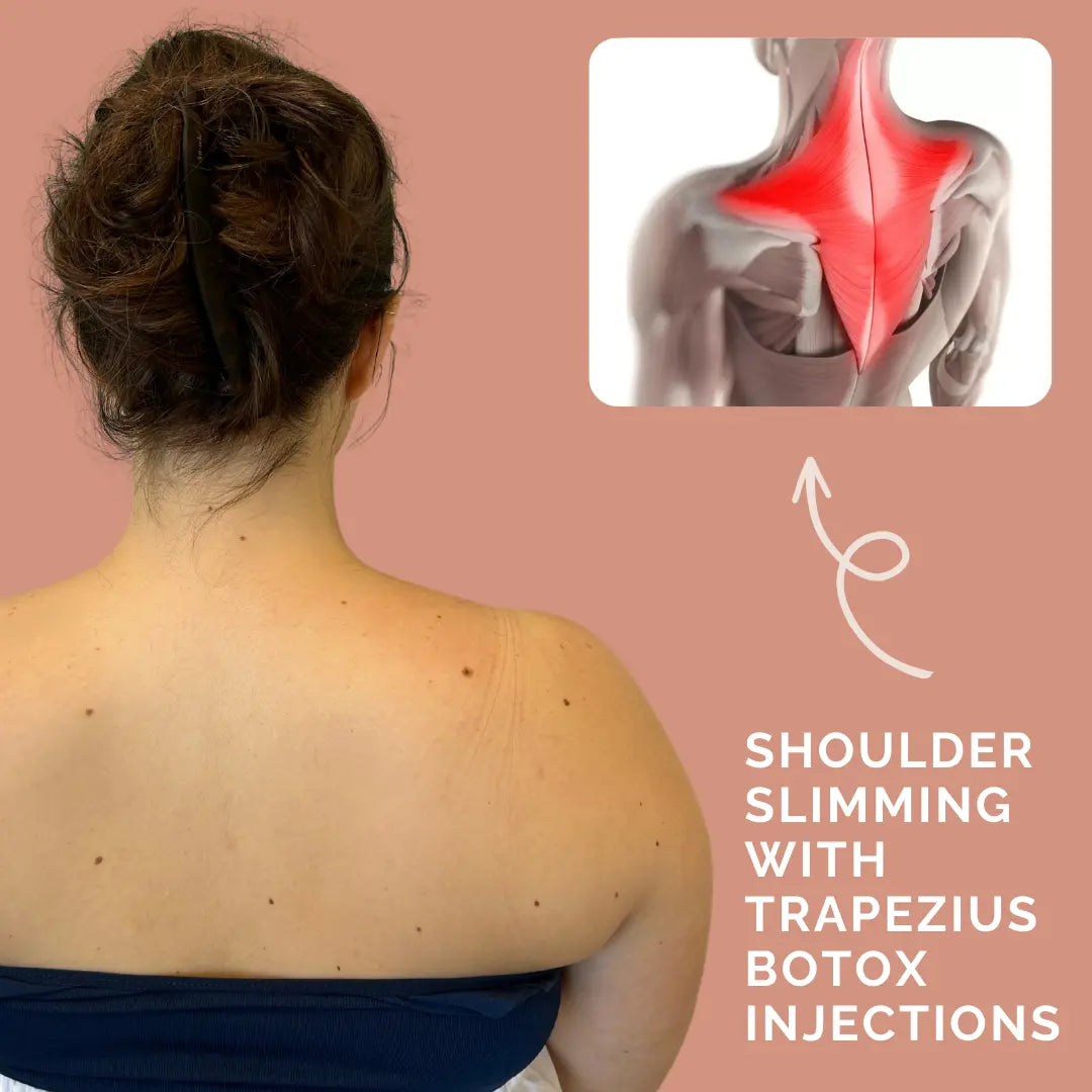 picture of a woman's trapezius muscles with anatomical image of trapezius muscles