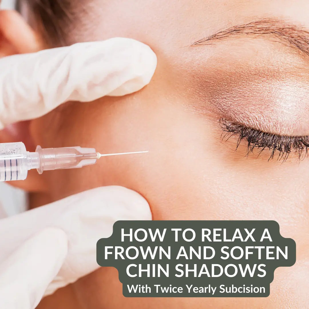 subcision for chin shadows at colorado beauty rn