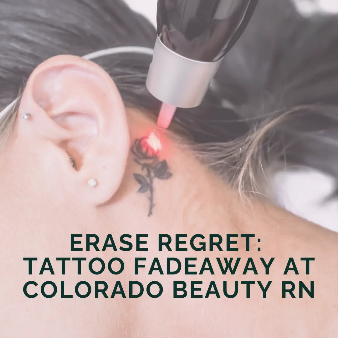 Erase Regret: Tattoo Fadeaway at Colorado Beauty RN - ColoradoBeautyRN
