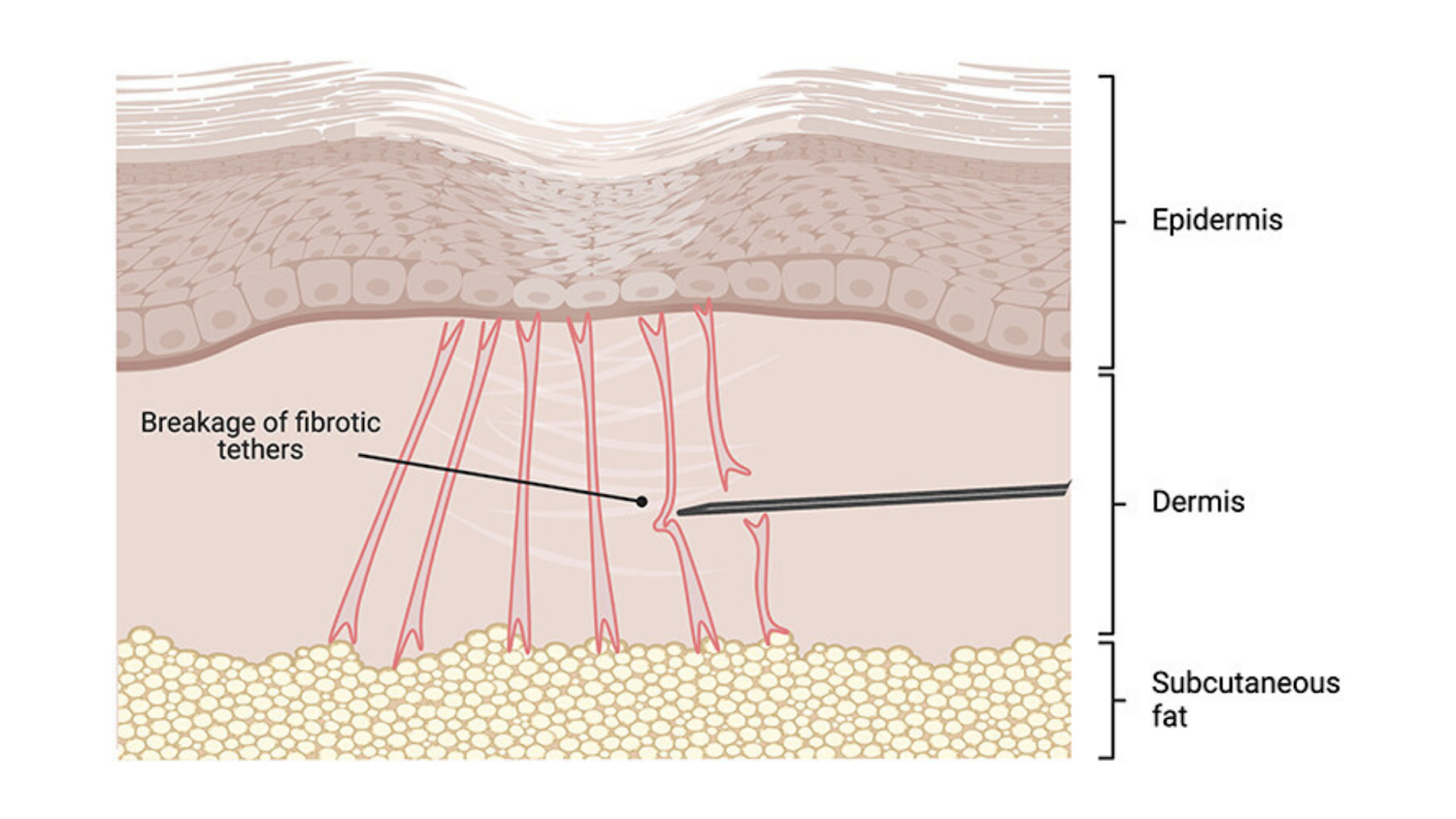 a diagram of a skin structure