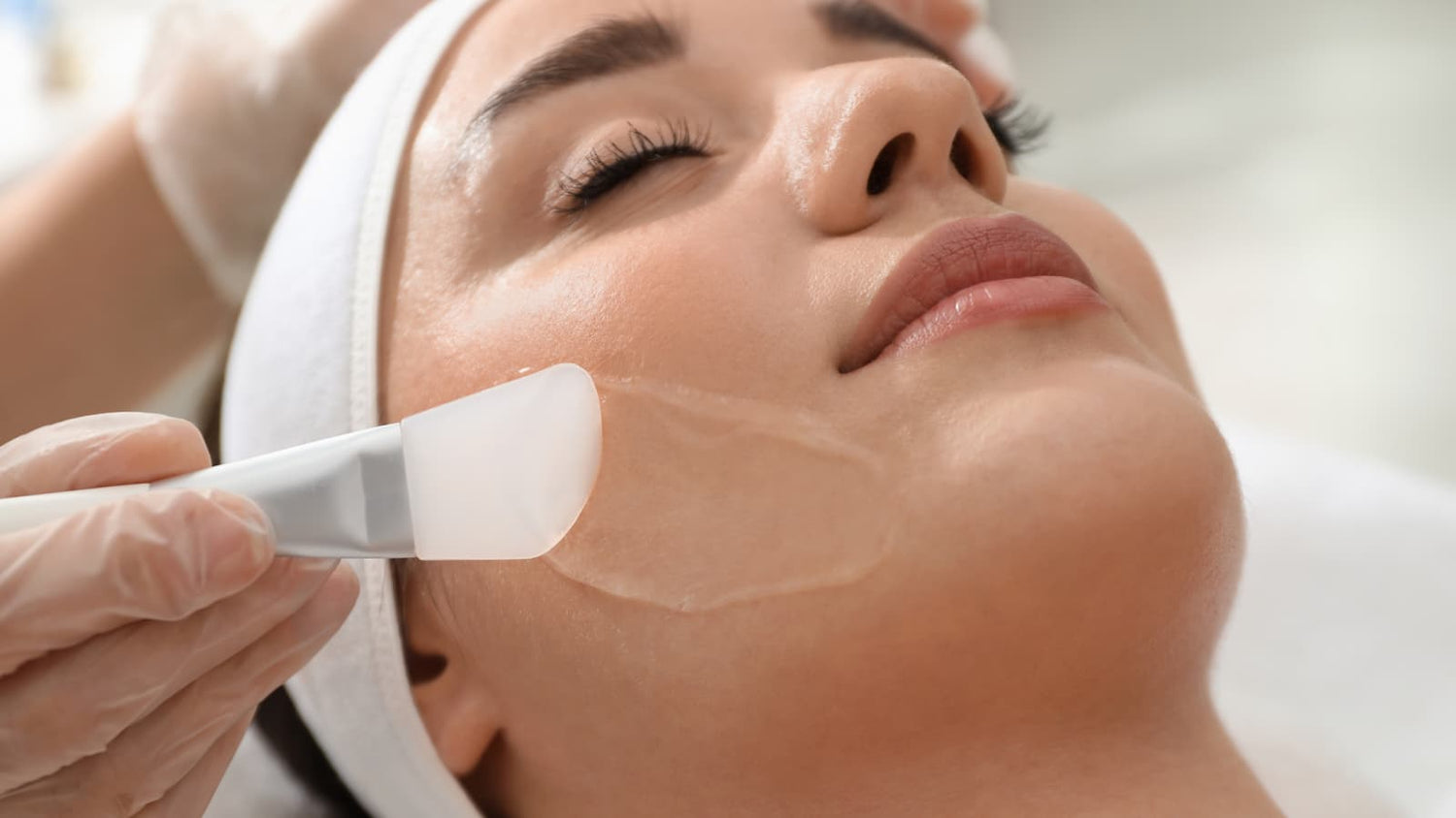 a person getting a invisapeel + dermaplane treatment