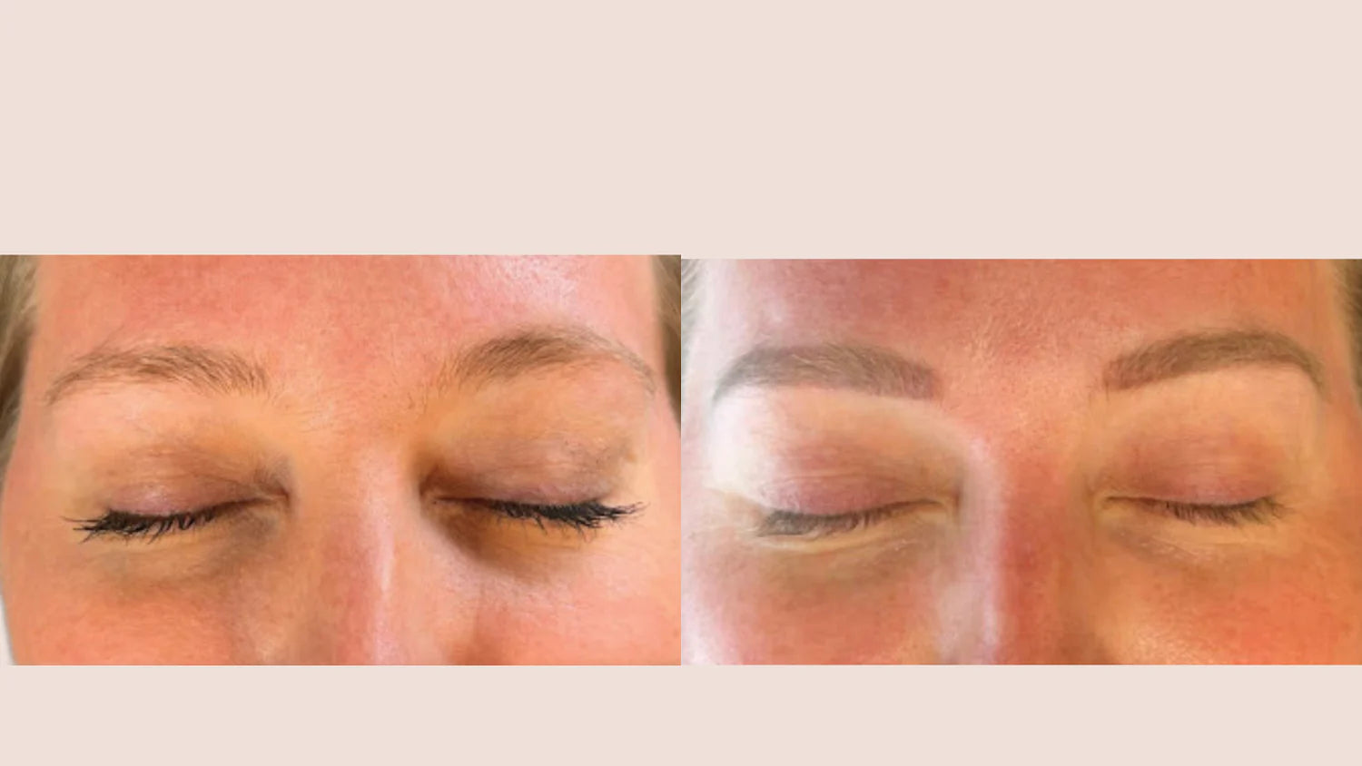 before & after permanent makeup