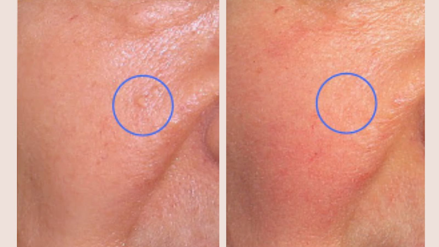 Skin Classic: Before & After Transformation